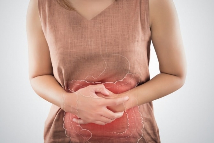 Síndrome do intestino irritável. Quando procurar um médico?